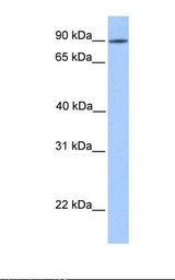 721_B cell lysate. Antibody concentration: 1.0 ug/ml. Gel concentration: 12%.