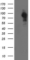 HEK293T cells were transfected with the pCMV6-ENTRY control (Left lane) or pCMV6-ENTRY LRRC50 (Right lane) cDNA for 48 hrs and lysed. Equivalent amounts of cell lysates (5 ug per lane) were separated by SDS-PAGE and immunoblotted with anti-LRRC50.