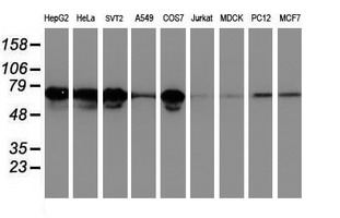 Western blot of extracts (35ug) from 9 different cell lines by using anti-LRRC50 monoclonal antibody.