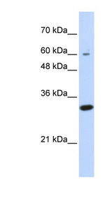 LRRC57 antibody LS-C102667 Western blot of Transfected 293T cell lysate.