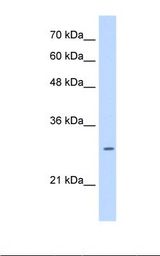 HepG2 cell lysate. Antibody concentration: 0.25 ug/ml. Gel concentration: 12%.