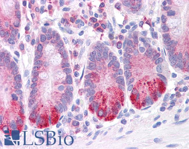 Anti-LRRC59 antibody IHC of human small intestine. Immunohistochemistry of formalin-fixed, paraffin-embedded tissue after heat-induced antigen retrieval. Antibody LS-B4672 concentration 5 ug/ml.