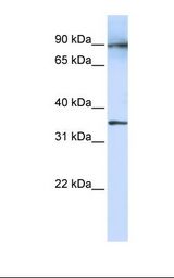Fetal lung lysate. Antibody concentration: 1.0 ug/ml. Gel concentration: 12%.