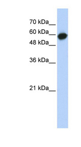 LRRC6 antibody LS-C102548 Western blot of Transfected 293T cell lysate.