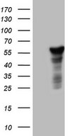 HEK293T cells were transfected with the pCMV6-ENTRY control (Left lane) or pCMV6-ENTRY LRRC6 (Right lane) cDNA for 48 hrs and lysed. Equivalent amounts of cell lysates (5 ug per lane) were separated by SDS-PAGE and immunoblotted with anti-LRRC6.