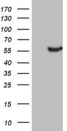 HEK293T cells were transfected with the pCMV6-ENTRY control (Left lane) or pCMV6-ENTRY LRRC6 (Right lane) cDNA for 48 hrs and lysed. Equivalent amounts of cell lysates (5 ug per lane) were separated by SDS-PAGE and immunoblotted with anti-LRRC6.