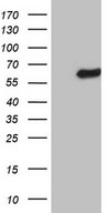 HEK293T cells were transfected with the pCMV6-ENTRY control (Left lane) or pCMV6-ENTRY LRRC6 (Right lane) cDNA for 48 hrs and lysed. Equivalent amounts of cell lysates (5 ug per lane) were separated by SDS-PAGE and immunoblotted with anti-LRRC6.