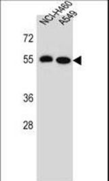 LRRC6 Antibody western blot of NCI-H460,A549 cell line lysates (35 ug/lane). The LRRC6 antibody detected the LRRC6 protein (arrow).