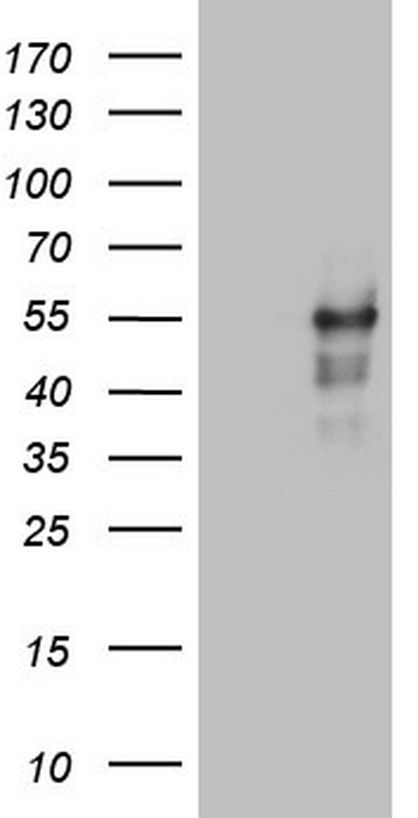 HEK293T cells were transfected with the pCMV6-ENTRY control (Left lane) or pCMV6-ENTRY LRRC6 (Right lane) cDNA for 48 hrs and lysed. Equivalent amounts of cell lysates (5 ug per lane) were separated by SDS-PAGE and immunoblotted with anti-LRRC6.