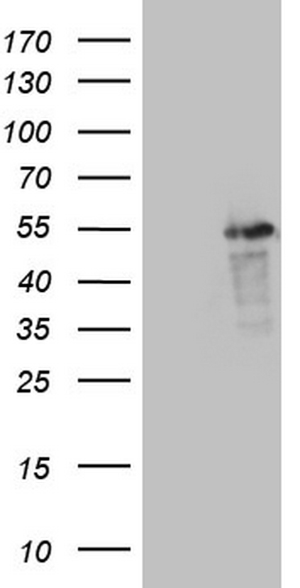 HEK293T cells were transfected with the pCMV6-ENTRY control (Left lane) or pCMV6-ENTRY LRRC6 (Right lane) cDNA for 48 hrs and lysed. Equivalent amounts of cell lysates (5 ug per lane) were separated by SDS-PAGE and immunoblotted with anti-LRRC6.