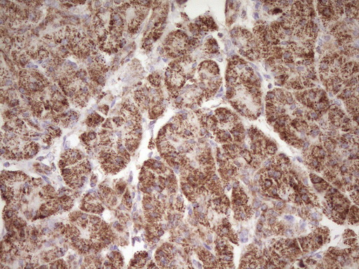 IHC of paraffin-embedded Human pancreas tissue using anti-LRRC6 mouse monoclonal antibody. (Heat-induced epitope retrieval by 1 mM EDTA in 10mM Tris, pH8.5, 120°C for 3min).