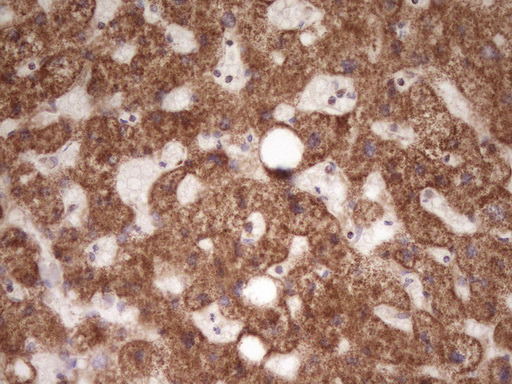 IHC of paraffin-embedded Human liver tissue using anti-LRRC6 mouse monoclonal antibody. (Heat-induced epitope retrieval by 1 mM EDTA in 10mM Tris, pH8.5, 120°C for 3min).