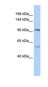 LRRC66 antibody LS-C102135 Western blot of Jurkat lysate.
