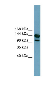 LRRC66 antibody LS-C116276 Western blot of ACHN lysate.