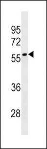 LRRC69 Antibody western blot of HepG2 cell line lysates (35 ug/lane). The LRRC69 antibody detected the LRRC69 protein (arrow).