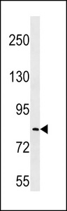 LRRC70 Antibody western blot of MDA-MB231 cell line lysates (35 ug/lane). The LRRC70 antibody detected the LRRC70 protein (arrow).