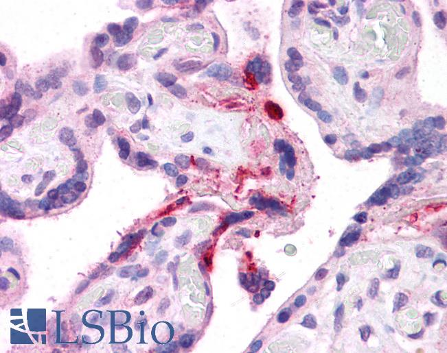 Anti-LRRC8B antibody IHC of human placenta. Immunohistochemistry of formalin-fixed, paraffin-embedded tissue after heat-induced antigen retrieval. Antibody LS-B4665 concentration 5 ug/ml.