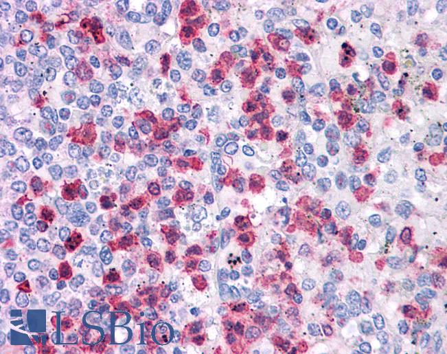 Anti-LRRC8B antibody IHC of human spleen. Immunohistochemistry of formalin-fixed, paraffin-embedded tissue after heat-induced antigen retrieval. Antibody LS-B4665 concentration 5 ug/ml.