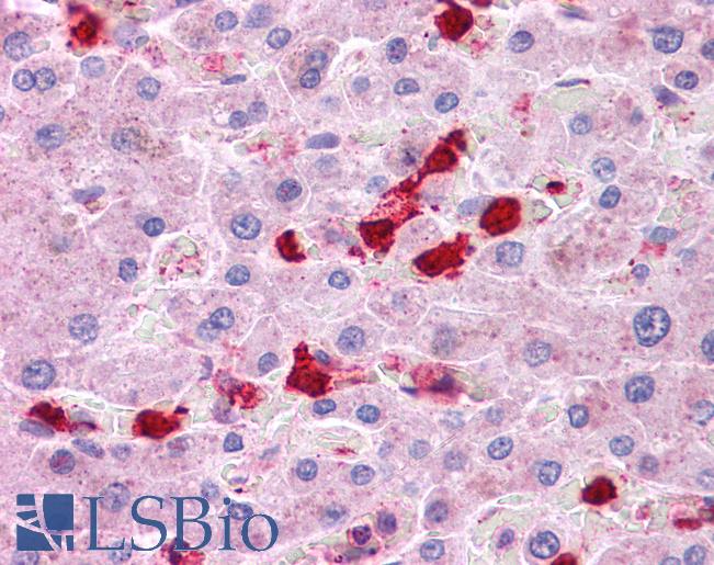 Anti-LRRC8B antibody IHC of human liver. Immunohistochemistry of formalin-fixed, paraffin-embedded tissue after heat-induced antigen retrieval. Antibody LS-B4665 concentration 5 ug/ml.