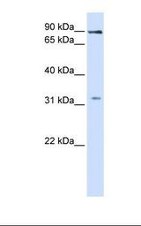 Fetal liver lysate. Antibody concentration: 1.0 ug/ml. Gel concentration: 12%.