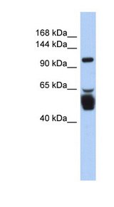 LRRC8B antibody LS-C111133 Western blot of Fetal Stomach lysate.