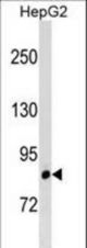 LRRIQ3 Antibody western blot of HepG2 cell line lysates (35 ug/lane). The LRRIQ3 antibody detected the LRRIQ3 protein (arrow).