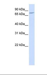 Placenta lysate. Antibody concentration: 1.0 ug/ml. Gel concentration: 12%.