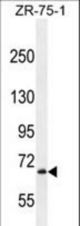 LRRN3 Antibody western blot of ZR-75-1 cell line lysates (35 ug/lane). The LRRN3 antibody detected the LRRN3 protein (arrow).