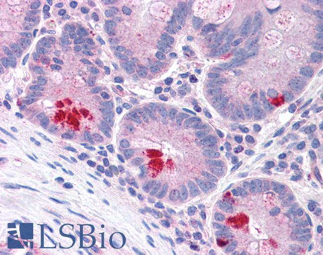 Anti-LRRN4 / C20orf75 antibody LS-A9531 IHC of human, small intestine. Immunohistochemistry of formalin-fixed, paraffin-embedded tissue after heat-induced antigen retrieval.