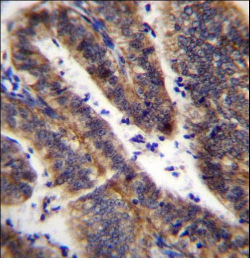 LRRN4CL Antibody immunohistochemistry of formalin-fixed and paraffin-embedded human uterus tissue followed by peroxidase-conjugated secondary antibody and DAB staining.