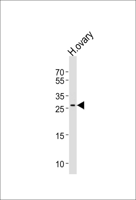 Western blot of lysate from human ovary tissue lysate, using LRRN4CL Antibody. Antibody was diluted at 1:1000 at each lane. A goat anti-rabbit IgG H&L (HRP) at 1:5000 dilution was used as the secondary antibody. Lysate at 35ug per lane.