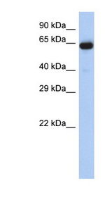 LRRTM1 antibody LS-C111704 Western blot of Placenta lysate.