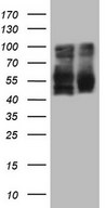 HEK293T cells were transfected with the pCMV6-ENTRY control (Left lane) or pCMV6-ENTRY LRRTM1 (Right lane) cDNA for 48 hrs and lysed. Equivalent amounts of cell lysates (5 ug per lane) were separated by SDS-PAGE and immunoblotted with anti-LRRTM1.