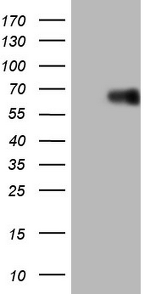HEK293T cells were transfected with the pCMV6-ENTRY control (Left lane) or pCMV6-ENTRY LRRTM1 (Right lane) cDNA for 48 hrs and lysed. Equivalent amounts of cell lysates (5 ug per lane) were separated by SDS-PAGE and immunoblotted with anti-LRRTM1.