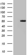HEK293T cells were transfected with the pCMV6-ENTRY control (Left lane) or pCMV6-ENTRY LRRTM1 (Right lane) cDNA for 48 hrs and lysed. Equivalent amounts of cell lysates (5 ug per lane) were separated by SDS-PAGE and immunoblotted with anti-LRRTM1.