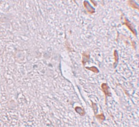 Immunohistochemistry of LRRTM1 in human brain tissue with LRRTM1 antibody at 5 ug/ml.