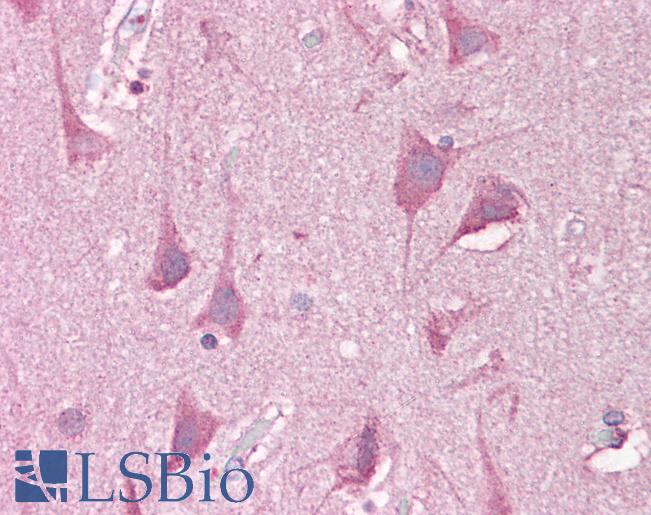 Anti-LRRTM2 antibody IHC of human brain, cortex. Immunohistochemistry of formalin-fixed, paraffin-embedded tissue after heat-induced antigen retrieval. Antibody LS-B7031 concentration 5 ug/ml.
