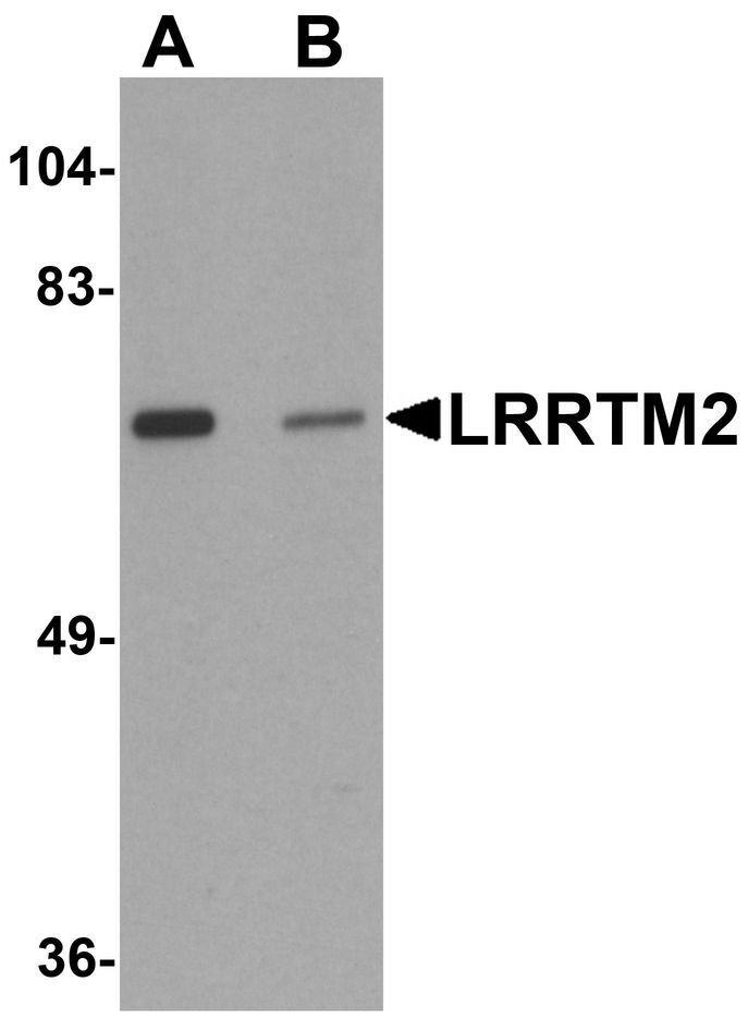 Western blot analysis of LRRTM2 in SK-N-SH cell lysate with LRRTM2 antibody at 1 ug/ml in (A) the absence and (B) the presence of blocking peptide.