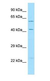 LRRTM3 antibody Western Blot of 293T.