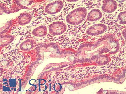 Anti-LRRTM3 antibody IHC staining of human small intestine. Immunohistochemistry of formalin-fixed, paraffin-embedded tissue after heat-induced antigen retrieval.