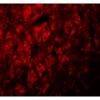 Immunofluorescence of LRRTM3 in human brain tissue with LRRTM3 antibody at 20 µg/mL.