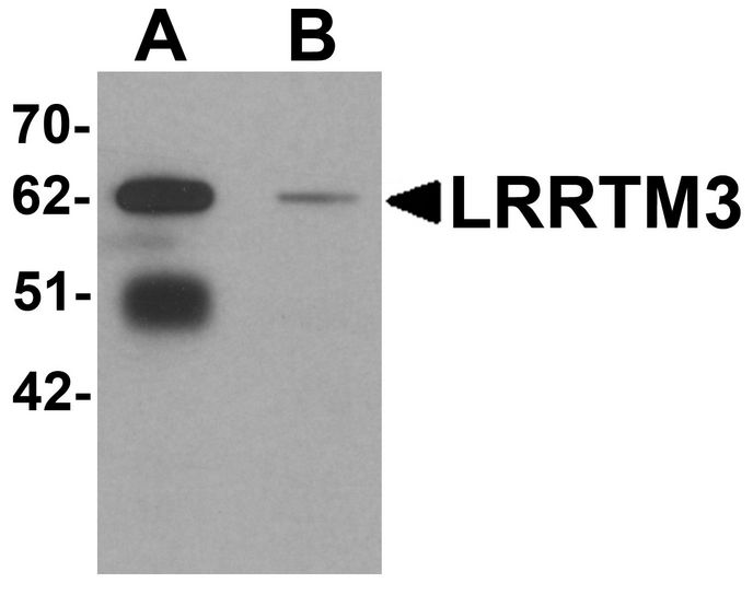 Western blot analysis of LRRTM3 in mouse brain tissue lysate with LRRTM3 antibody at 0.5 ug/ml in (A) the absence and (B) the presence of blocking peptide.