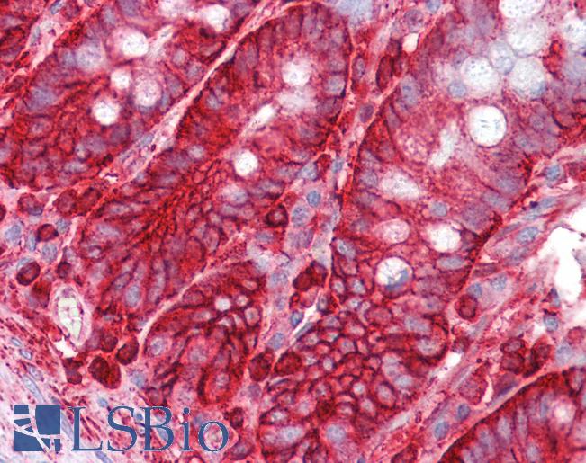 Anti-LRRTM4 antibody IHC of human small intestine. Immunohistochemistry of formalin-fixed, paraffin-embedded tissue after heat-induced antigen retrieval. Antibody LS-B7032 concentration 5 ug/ml.