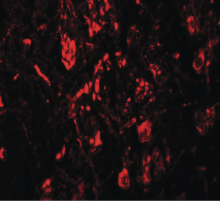 Immunofluorescence of LRRTM4 in human brain tissue with LRRTM4 antibody at 20 ug/ml.