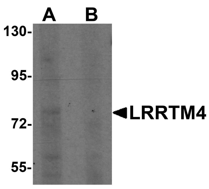 Western blot analysis of LRRTM4 in HeLa cell lysate with LRRTM4 antibody at 1 ug/ml in (A) the absence and (B) the presence of blocking peptide.