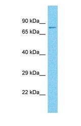 Western blot of LRSAM1 Antibody with human MCF7 Whole Cell lysate.