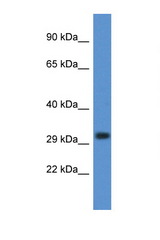 DNASE1L3 antibody LS-C145470 Western blot of Placenta lysate. Antibody concentration 1 ug/ml.