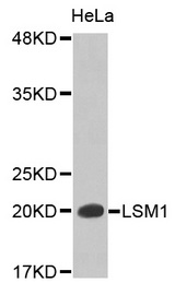 Western blot analysis of extracts of HeLa cell lines, using LSM1 antibody.