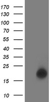 HEK293T cells were transfected with the pCMV6-ENTRY control (Left lane) or pCMV6-ENTRY LSM1 (Right lane) cDNA for 48 hrs and lysed. Equivalent amounts of cell lysates (5 ug per lane) were separated by SDS-PAGE and immunoblotted with anti-LSM1.