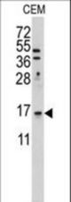 Western blot of anti-LSM1 Antibody in HeLa cell line lysates (35 ug/lane). LSM1 (arrow) was detected using the purified antibody.